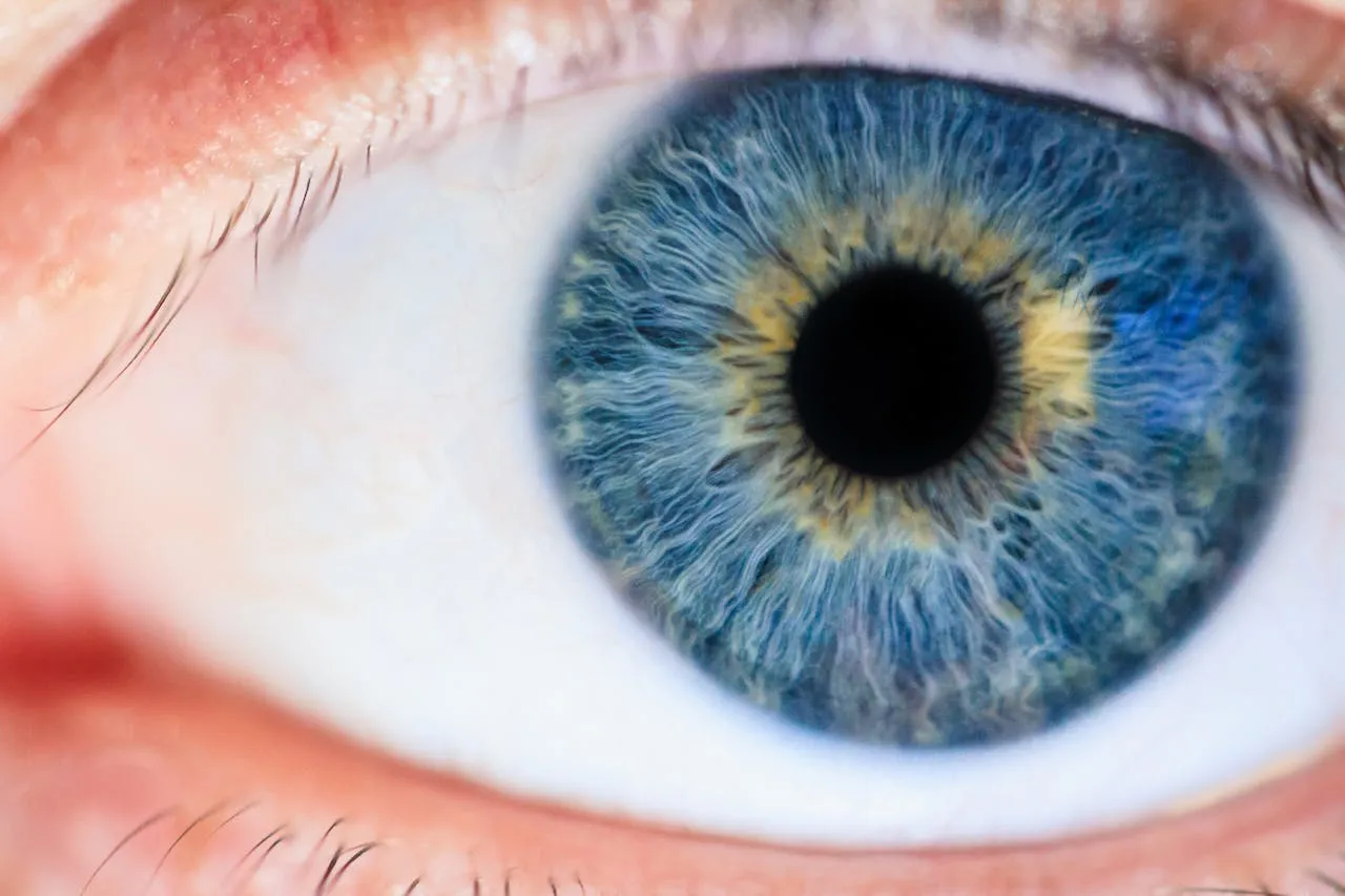 eye